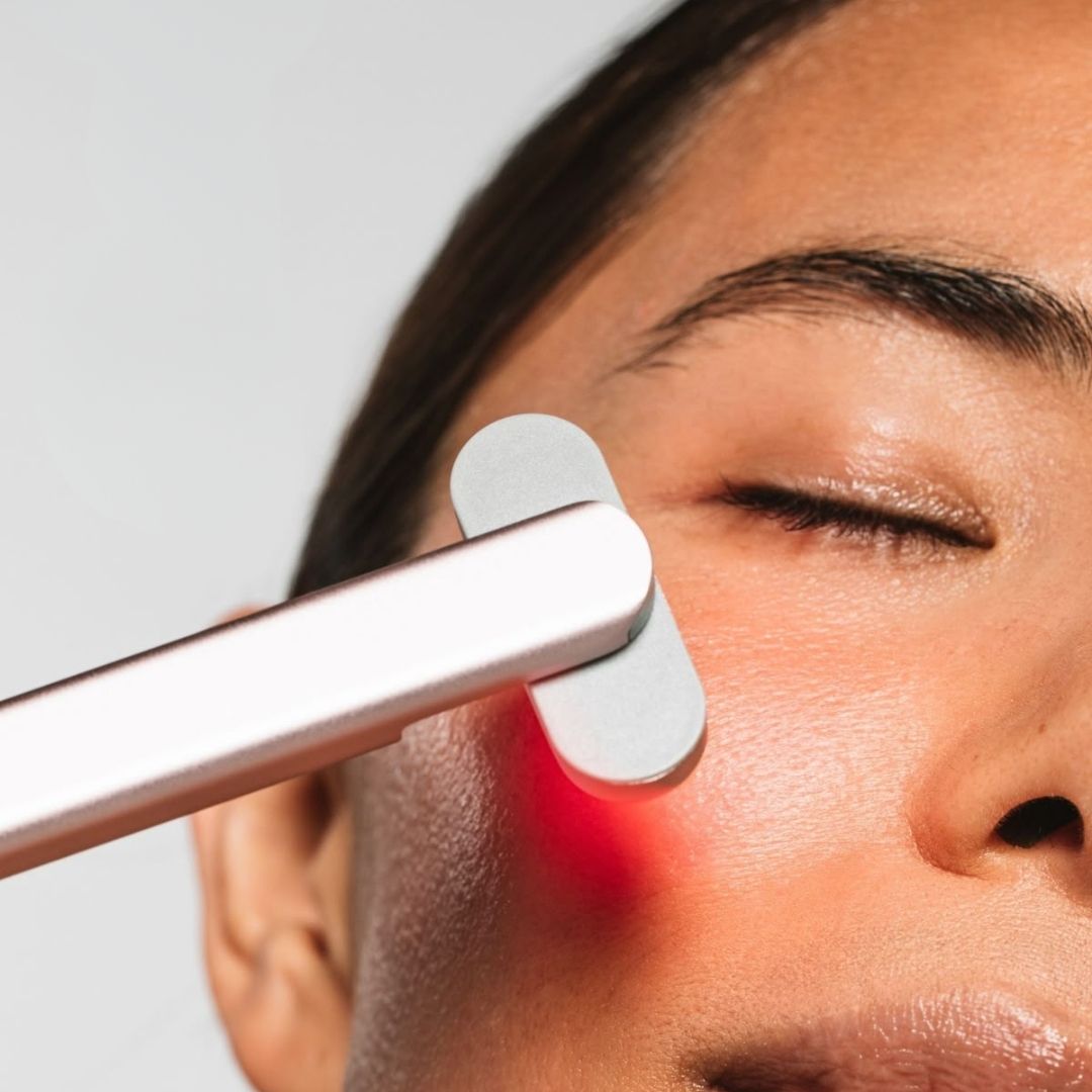 Come Eliminare le Occhiaie Consigli degli Esperti per uno Sguardo più Luminoso