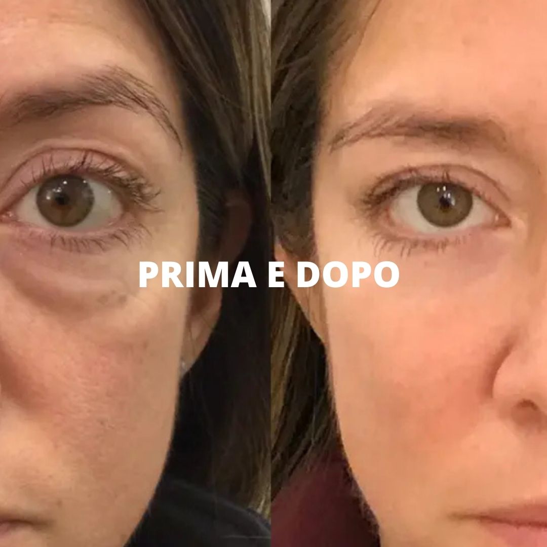 Terapia LED Viso: Tutto Quello che Devi Sapere