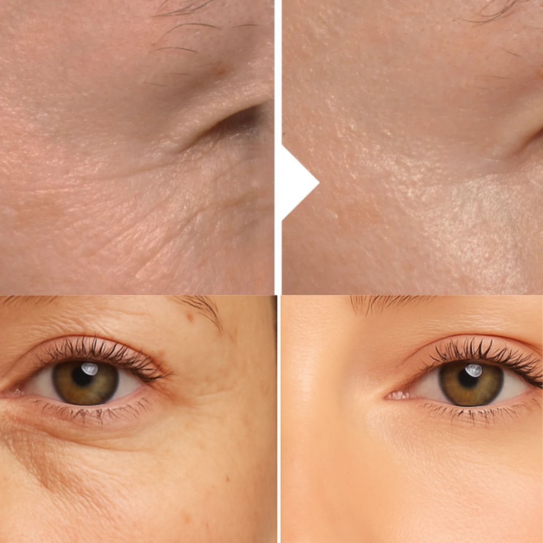 La bellezza che dura: perché un dispositivo LED viso prima e dopo può davvero fare la differenza